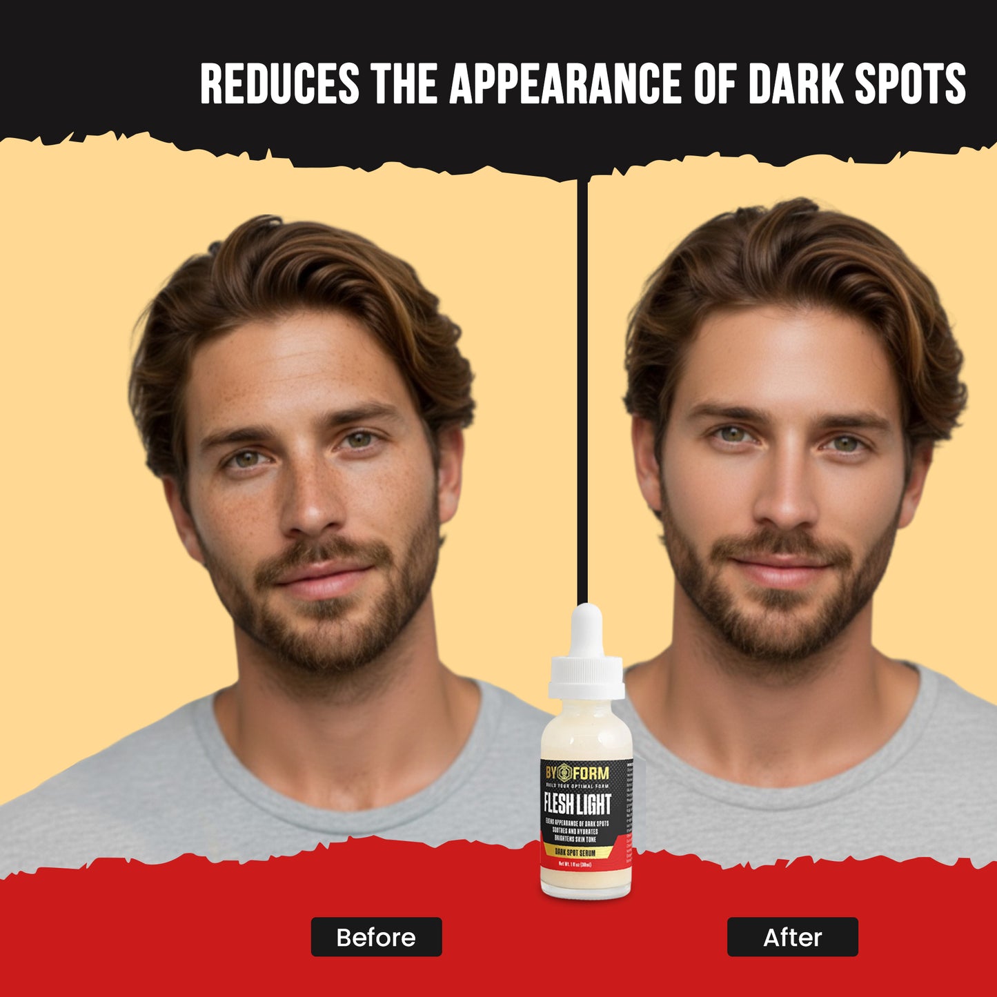 FLESH LIGHT: Dark Spot Serum